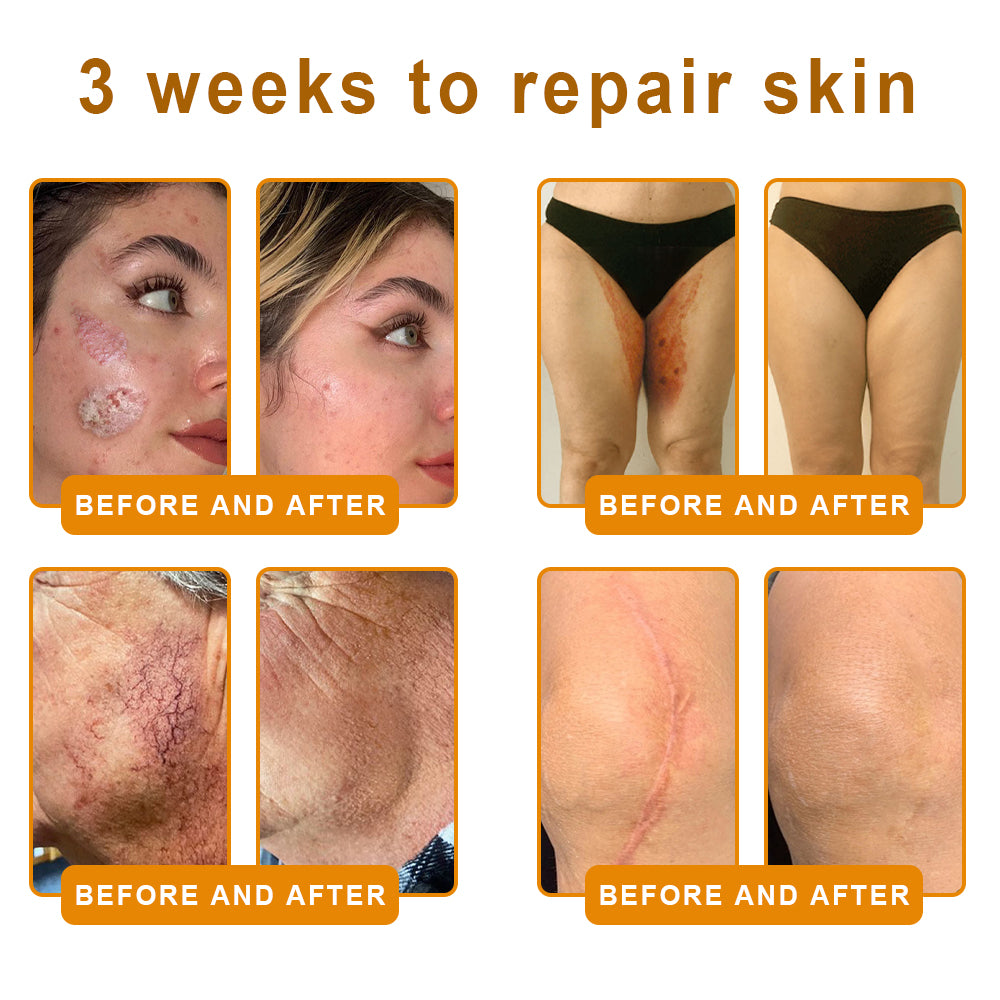 LOVILDS™ Bee Venom Cream – 🌸 Anti-Aging, Hydrating & Skin Repair