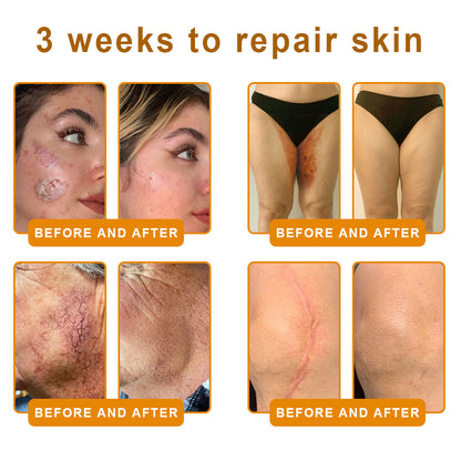 LOVILDS™ Bee Venom Cream – 🌸 Anti-Aging, Hydrating & Skin Repair